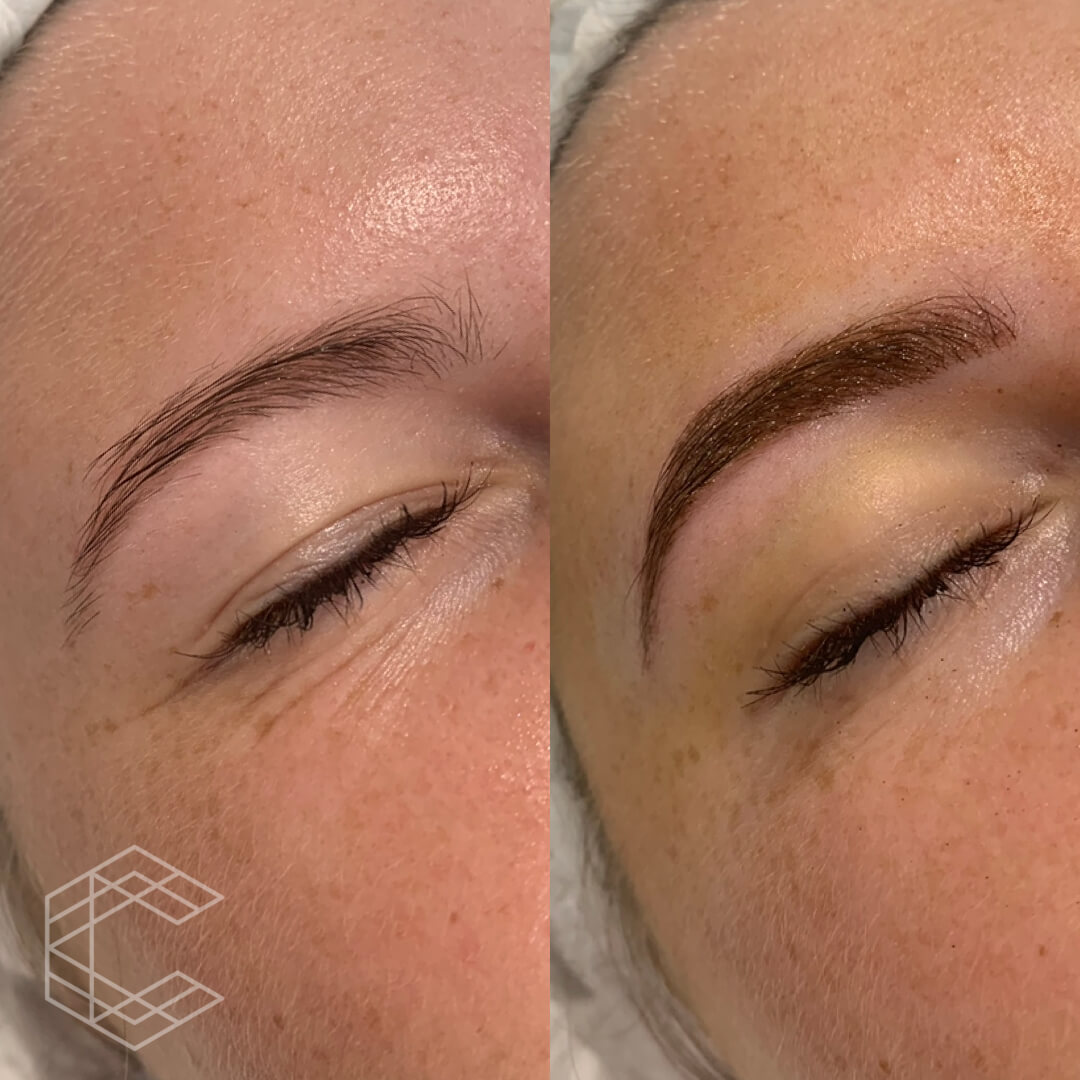 Differences Of Microblading And Microshading Complete Skin And Beauty